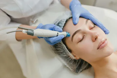 A woman being treated for acne