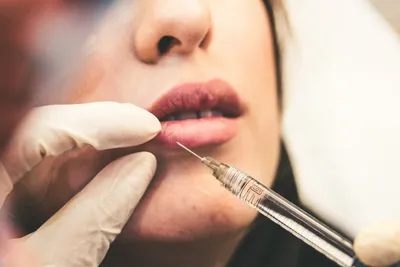 A woman receiving a botox injection