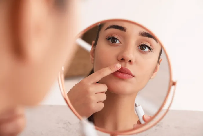 Woman inspecting cold sore on her lip