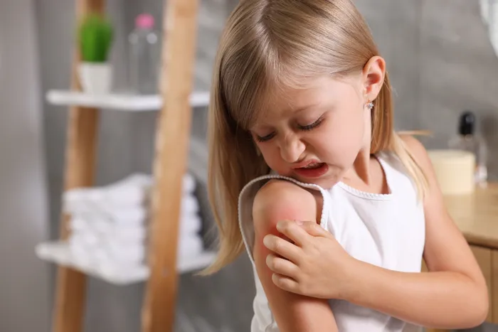 Child sick of her irritated, itchy skin