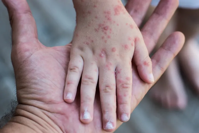 Doctor examining a patient with a rash