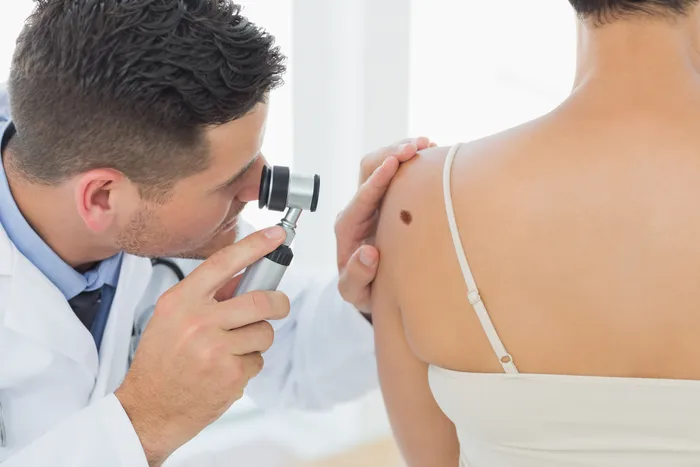 Patient having mole examined